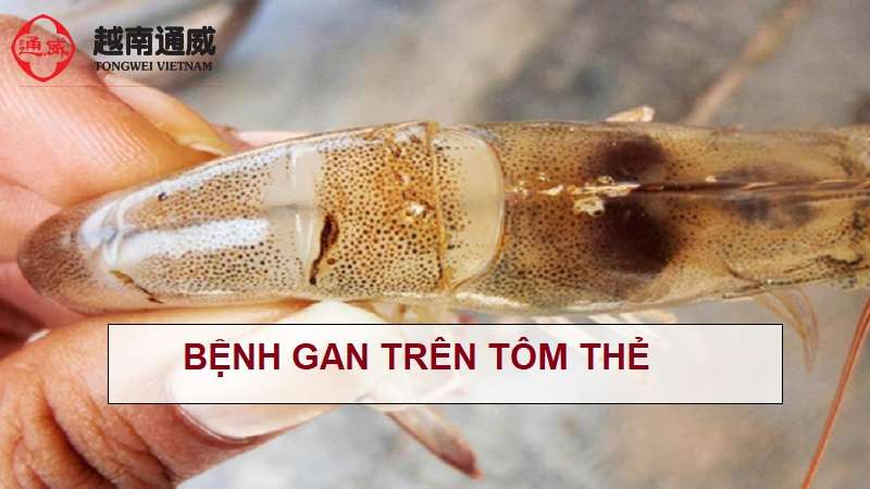 benh-gan-tren-tom-the