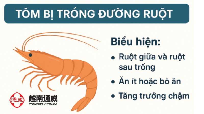 cach-chua-tom-bi-trong-duong-ruot-2 cach-chua-tom-bi-trong-duong-ruot-2